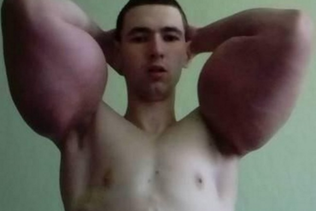 'Руки-базуки'