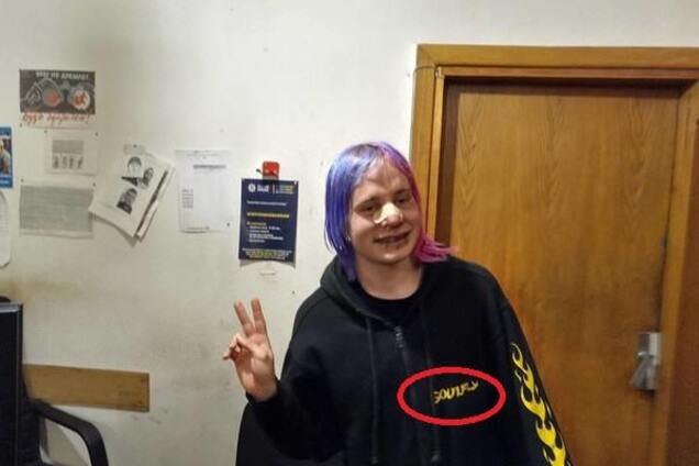 Дело не в волосах: жестокому избиению британца в Киеве нашли неожиданное оправдание