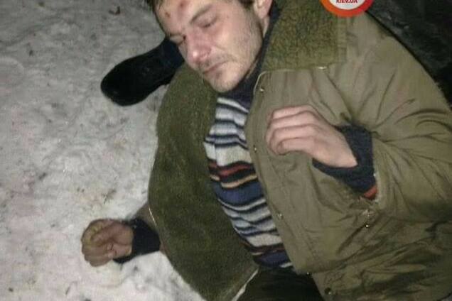 'Били по обличчю': лікарі несподівано пояснили відмову від вмираючого пацієнта в Києві