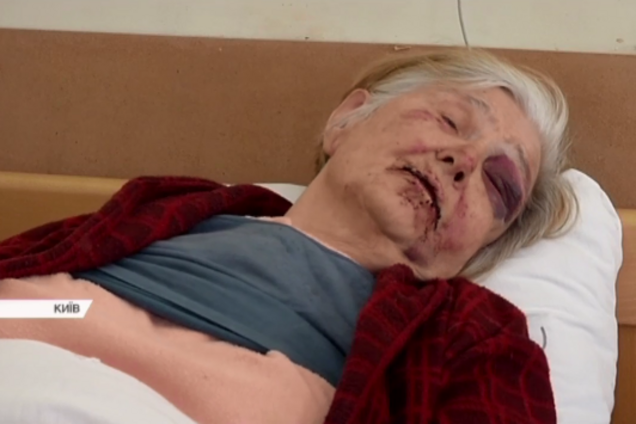 Пытали и рвали рот: в Киеве произошло зверское нападение на пенсионерку