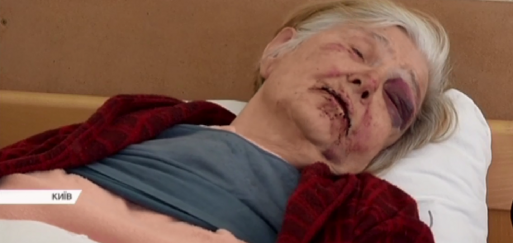 Пытали и рвали рот: в Киеве произошло зверское нападение на пенсионерку 