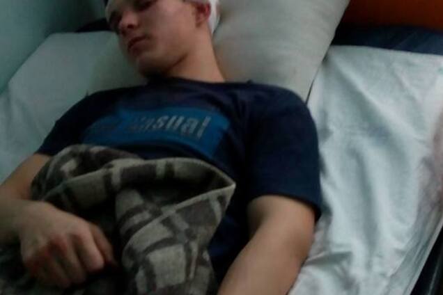 На Киевщине подростки до полусмерти избили сына чиновницы