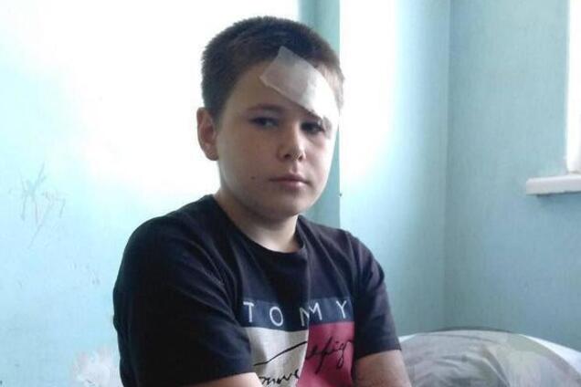 ''Наступили на розтяжку'': хлопчик, що вижив після вибуху у Горлівці, звинуватив ''ДНР''