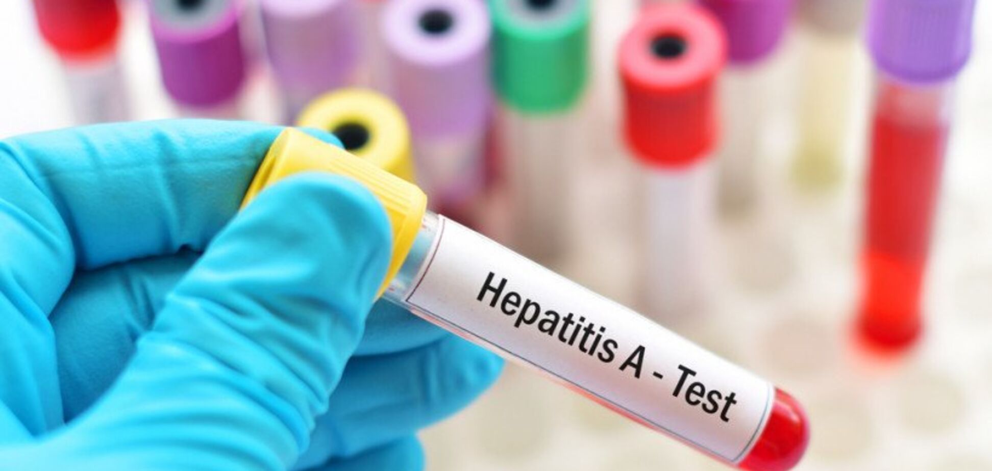 В Украине - вспышка гепатита: чем опасно и как уберечься 