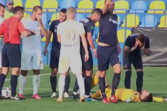 Українському голкіперу в матчі зламали обличчя - опубліковано відео