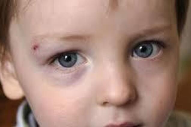 Скандал с тортом: в Украине предложили проверять учителей у психиатра