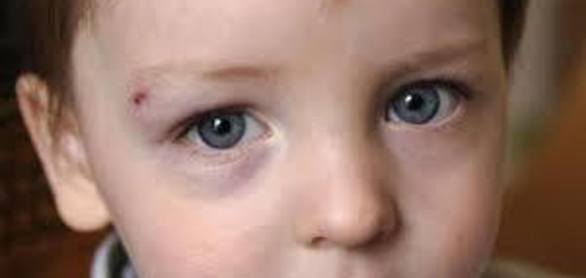 Скандал с тортом: в Украине предложили проверять учителей у психиатра