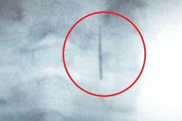 Врач забыл иглу в горле ребенка