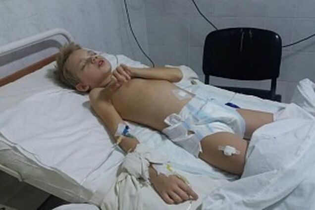 Умирал без диагноза 11 дней: мать рассказала о тяжелом состоянии ребенка в Бердянске
