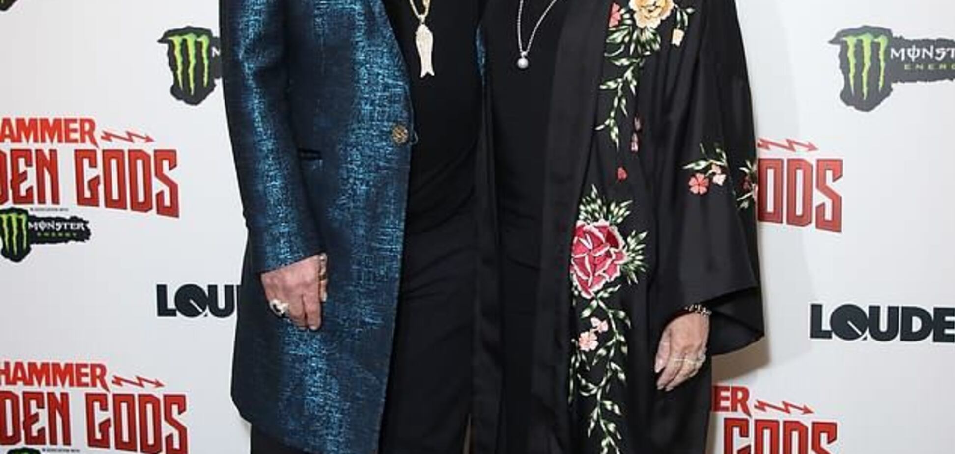 Легендарного рокера екстрено прооперували