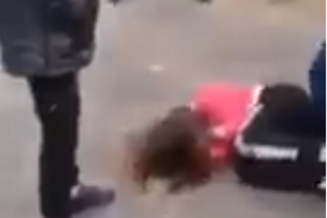  В России 14-летнюю школьницу зверски избили сверстники и сделали бесплодной: видео 18+ 