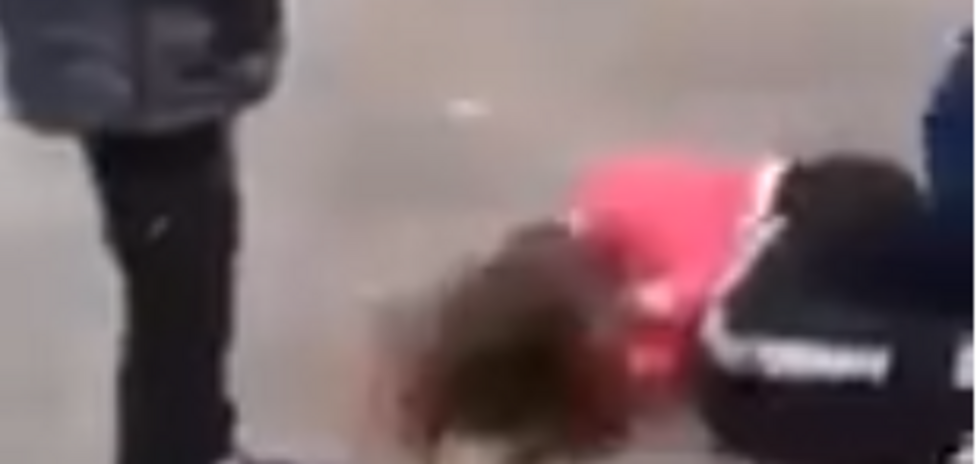  В России 14-летнюю школьницу зверски избили сверстники и сделали бесплодной: видео 18+ 