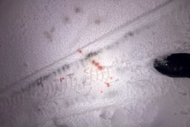 Кома и переломы: врач рассказал о состоянии детей после ''евроДТП'' под Киевом