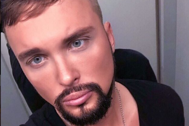 'Операція стала фатальною': зірка 'Дому-2' розповів, як його спотворили