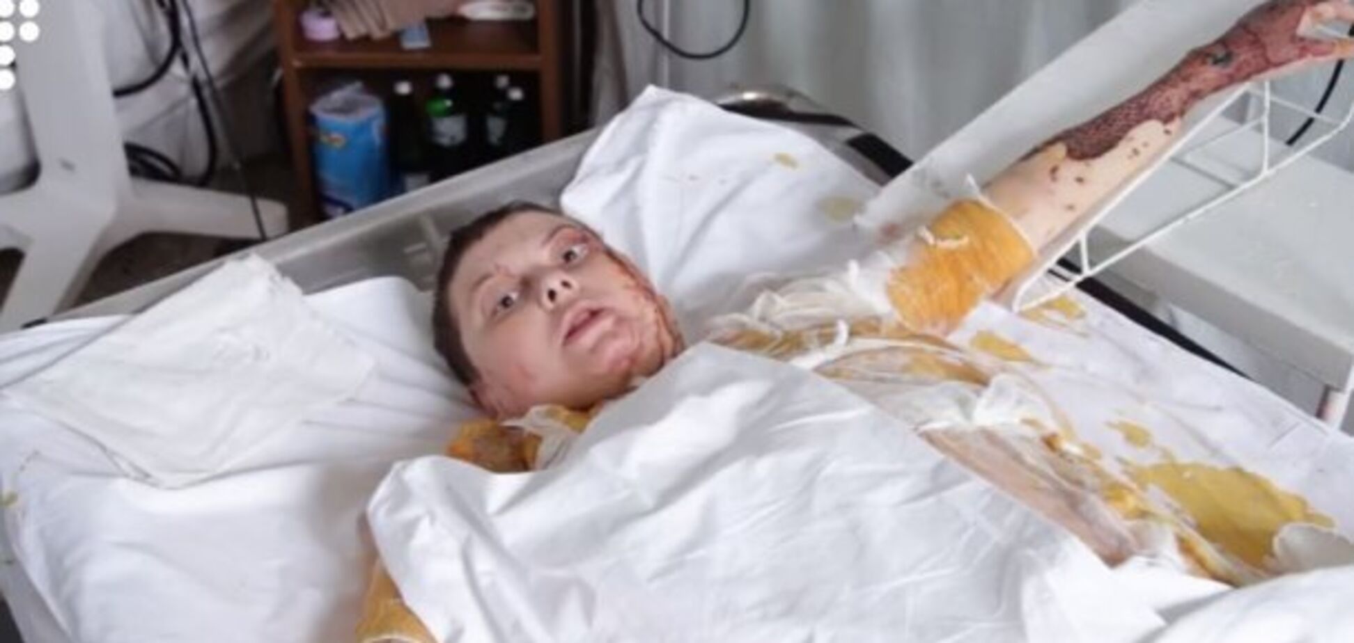 ''Терпела адские муки'': активист рассказал о последних днях жизни Гандзюк