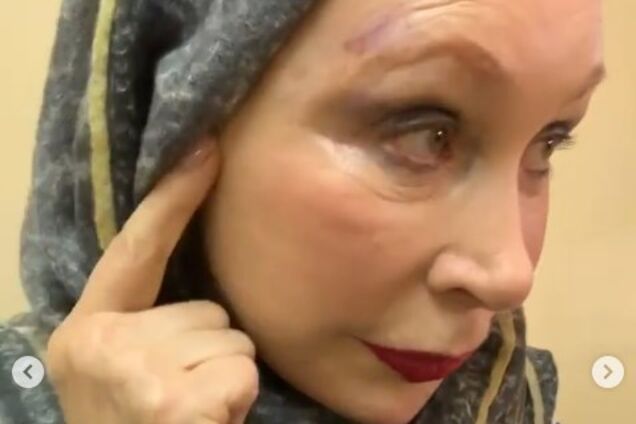 Народній артистці Росії в метро защемило голову: вона госпіталізована