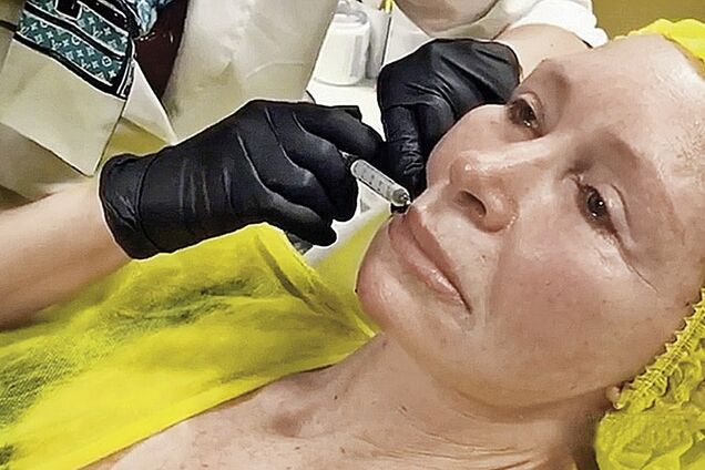 Затиснуло голову: російська актриса показалася на відео після пекельної поїздки в метро