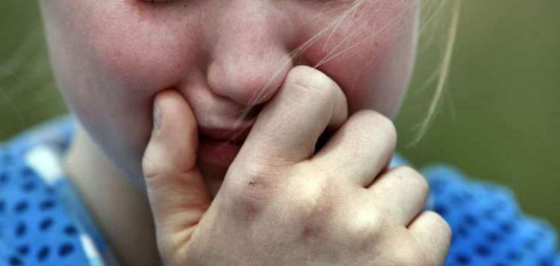 Напали на перемене: на Харьковщине школьники жестоко избили девочку