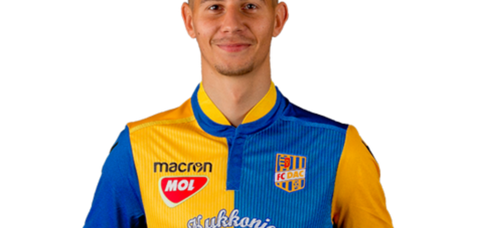 Зламали щелепу: гравця збірної Словаччини побили перед матчем із Україною