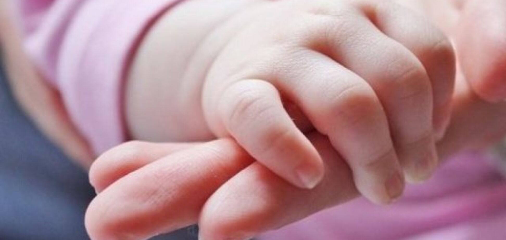 Ріс із живота: в Індії від дівчинки відокремили близнюка-паразита