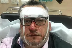 ''Так сделают во всем мире'': российского пропагандиста вышвырнули из больницы в Германии