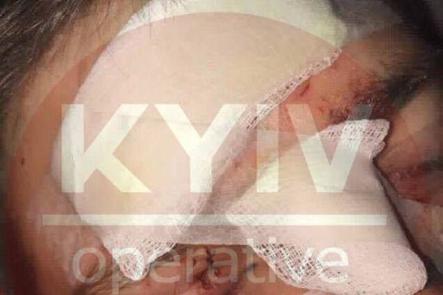 Наклали 19 швів: у Києві на концерті відомого гурту трапилася надзвичайна подія