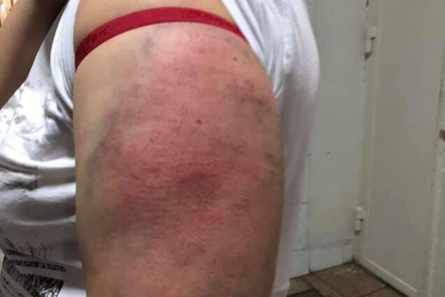 ''Били ногами беременную'': в Киеве полицейских обвинили в попытке изнасилования