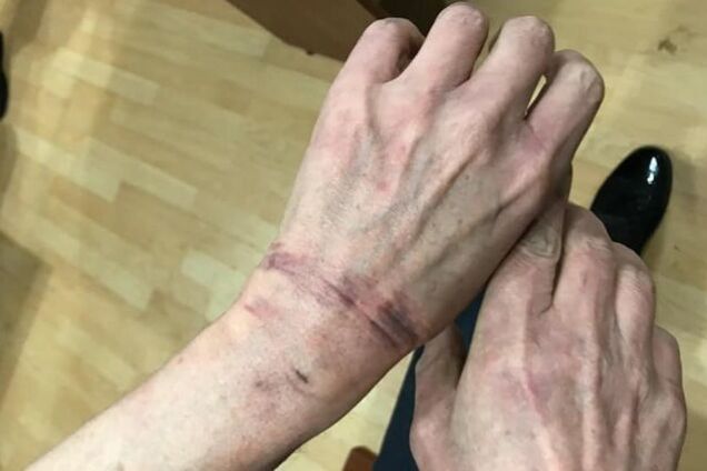 ''Оппоблок'' обратился к мировым лидерам из-за дела Ефремова