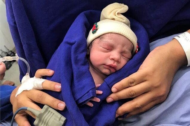В Бразилии впервые родился уникальный ребенок