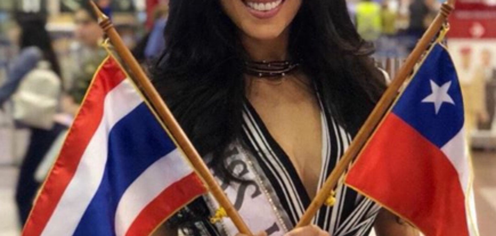 Претендентці на титул 'Міс Всесвіту-2018' спалили обличчя кислотою: фото до і після