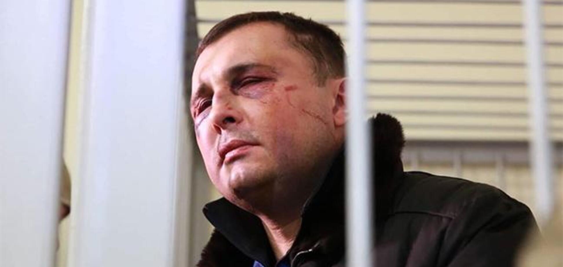 'Йому важко говорити': Матіос розповів про травми Шепелєва