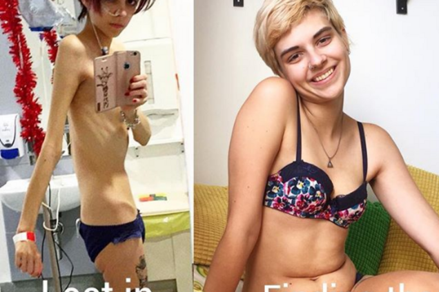 Конни Инглис