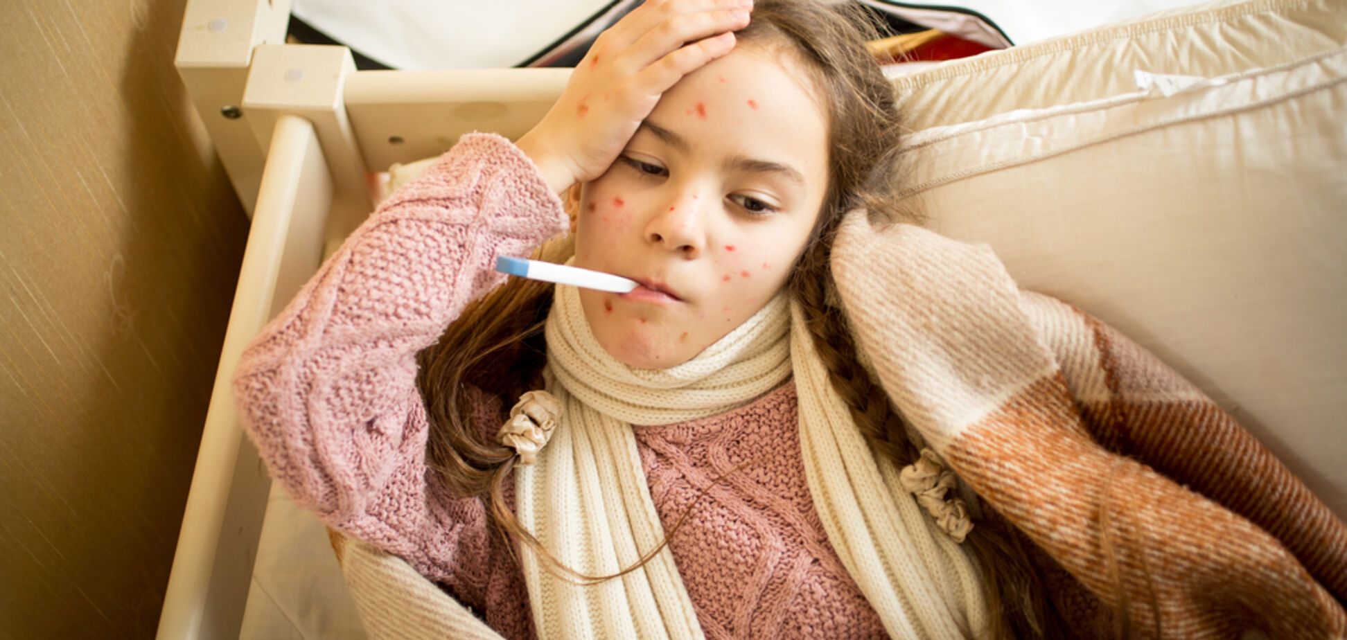 Спалах кору в Києві: кількість хворих різко зросла