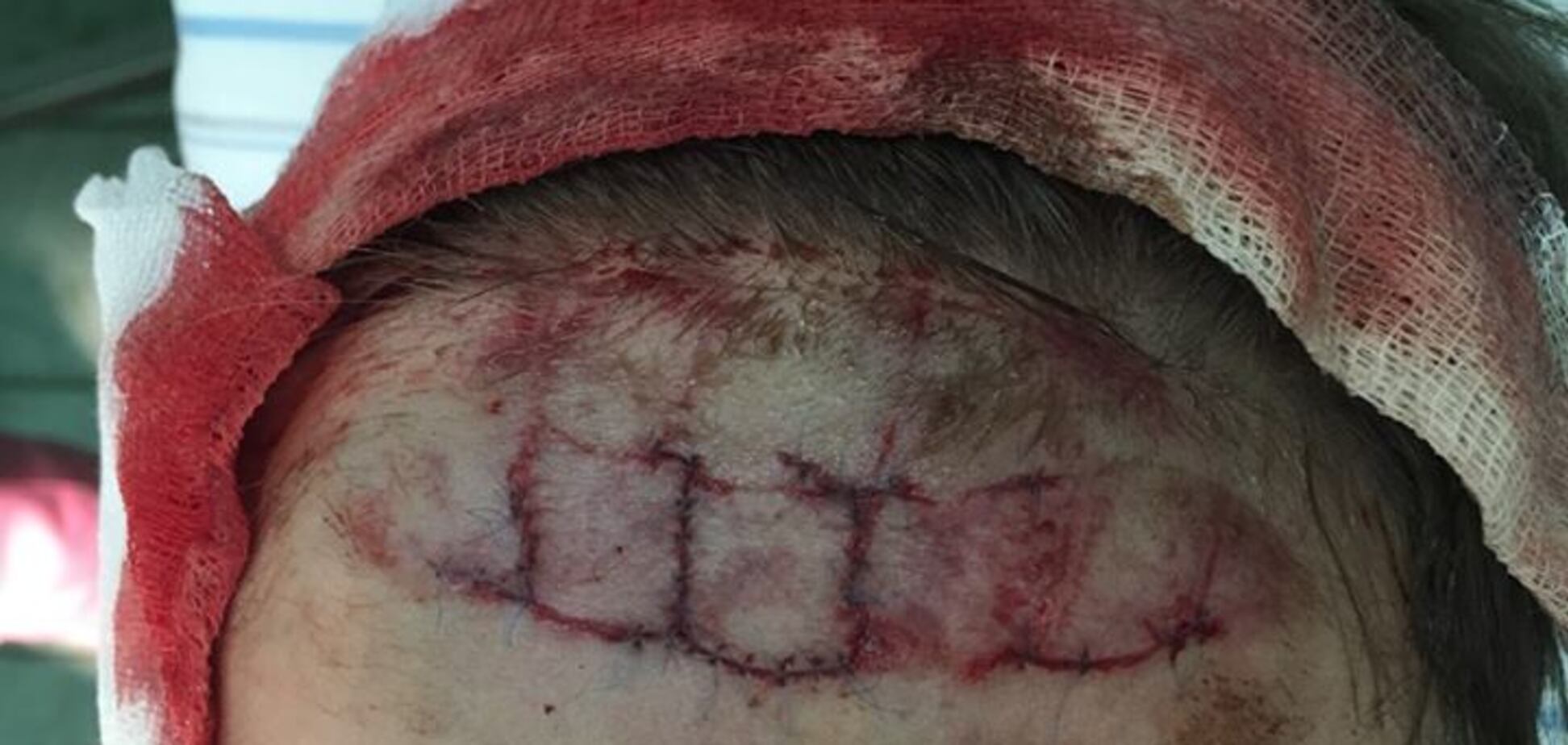 'Хлопчик подряпався': в аквапарку Києва розповіли свою версію НП