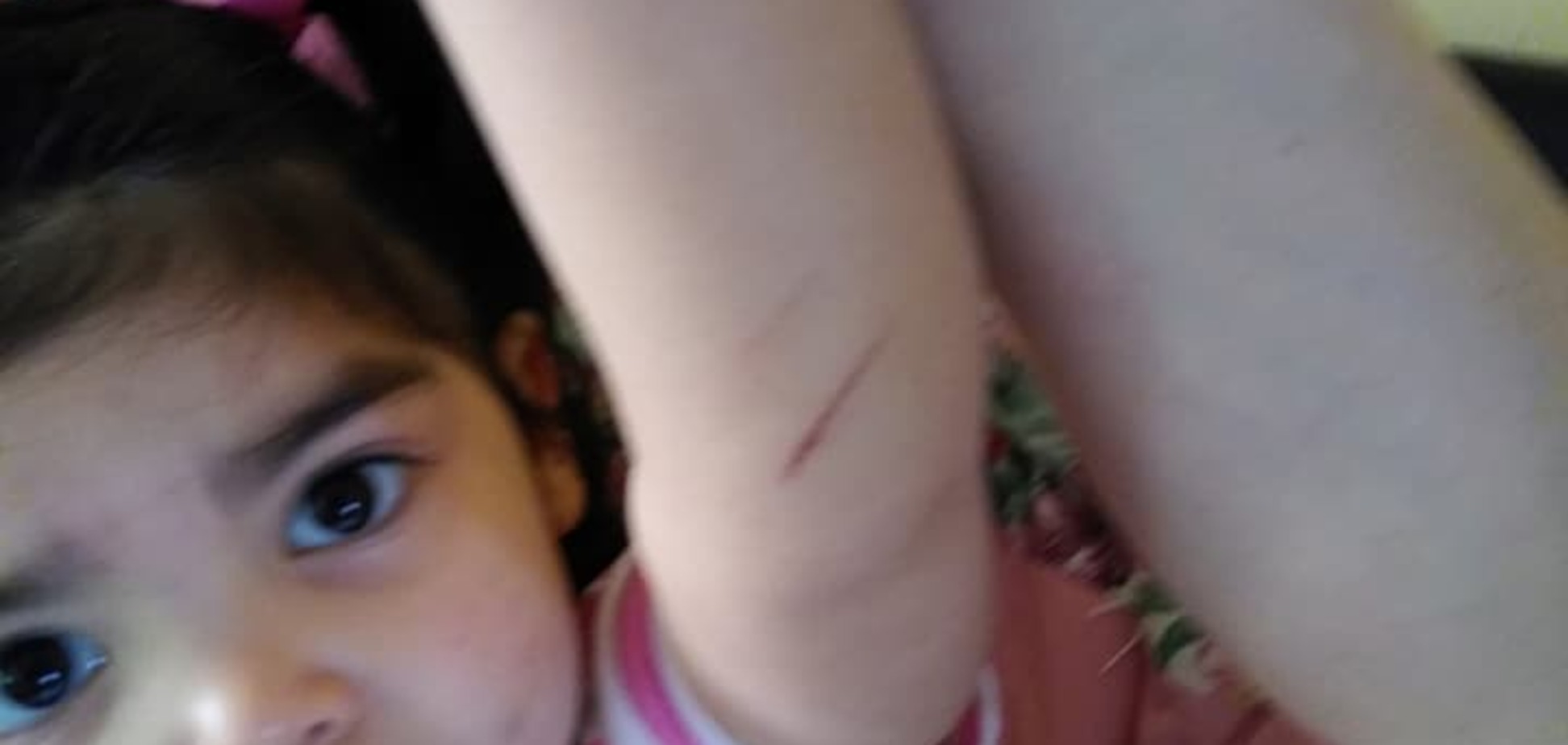 Воспитательниц из США поймали на эпиляции монобровей детям