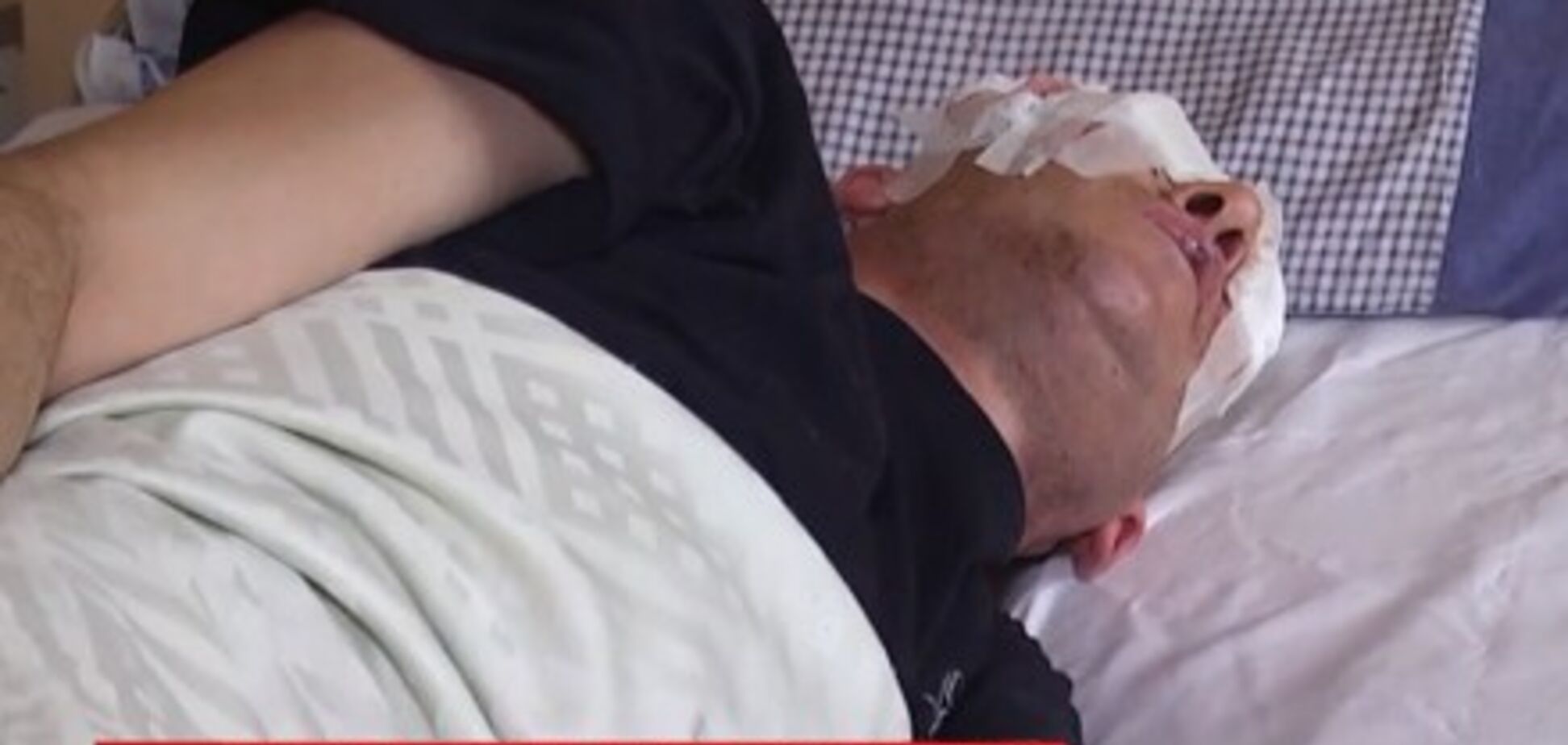 На Рівненщині мисливці за металом підірвалися на артилерійському детонаторі