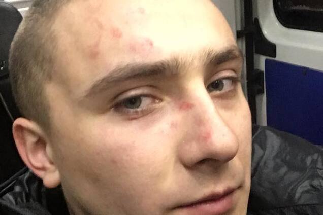 В Одессе напали на известного активиста Стерненко