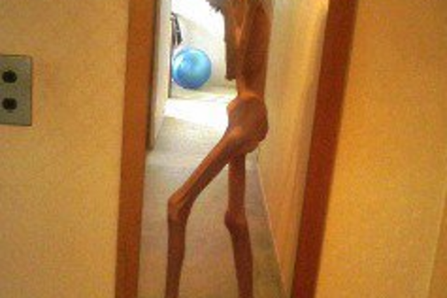 Японка, весившая 16 кг