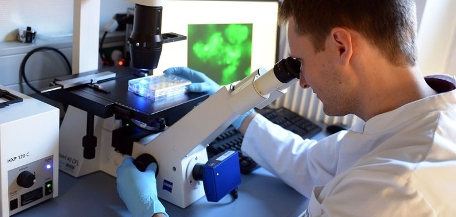 Як вилікувати особливий смертоносний рак: вчені знайшли спосіб