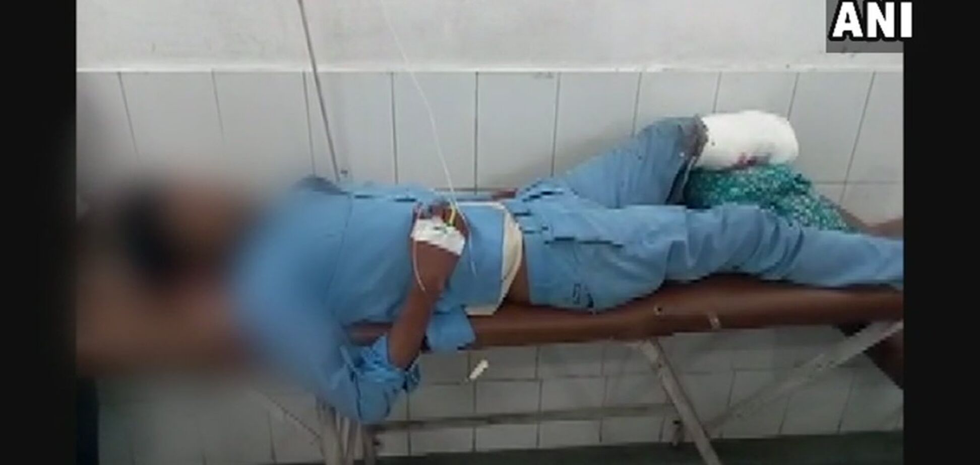 Отрезанная нога вместо подушки: появилось шокирующее видео из больницы в Индии