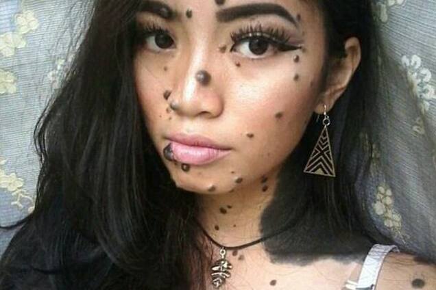 Модель з дефектами шкіри опинилася за крок від 'Міс Всесвіт'