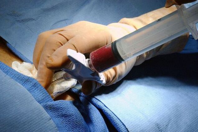 Міф МОЗу про революційний пілотний проект 'трансплантація'