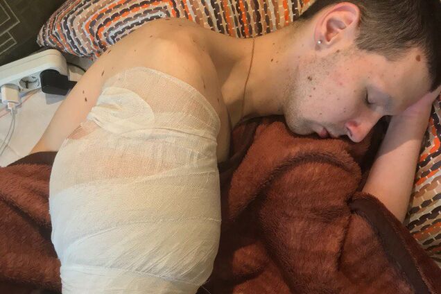 Кирилу 'Руки-базуки' різко стало погано