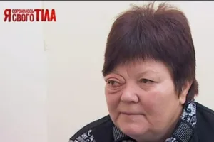 "Я соромлюсь свого тіла": как спасали выпадающий глаз