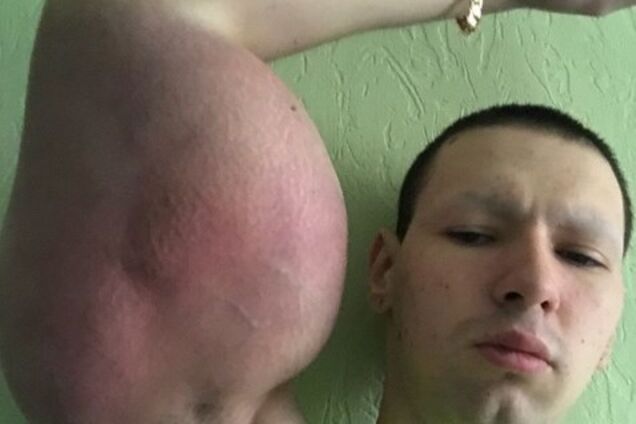 'Молюсь Богу': скандальный бодибилдер 'Руки-базуки' заявил, что умирает