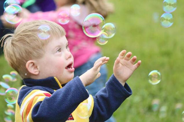 'Самі ви сонячні': в Житомирі педагог образила дітей з інвалідністю