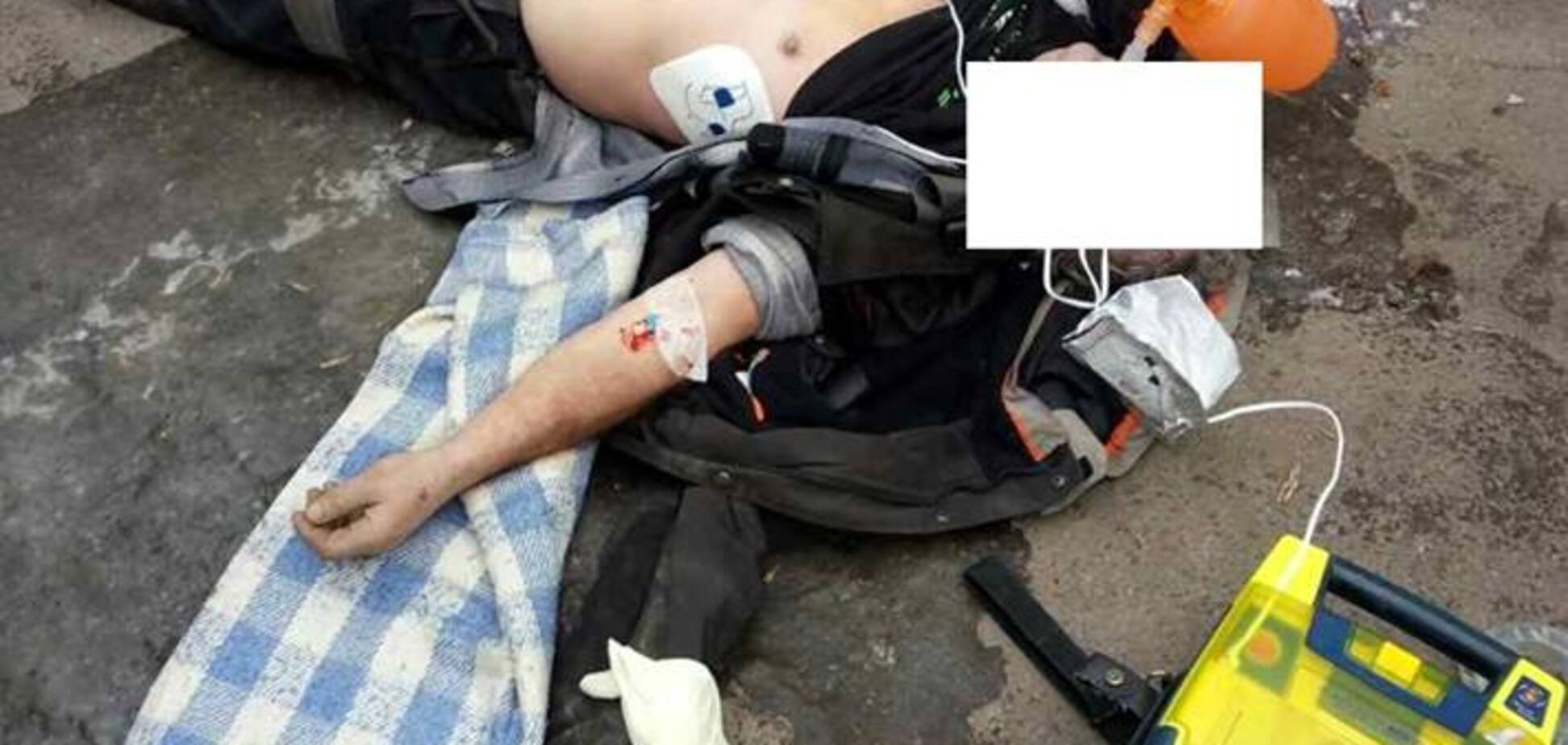 Медик розповів про жахливий випадок у Києві