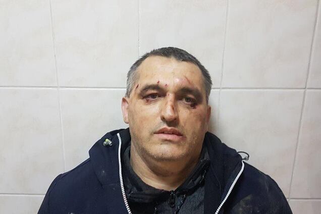 Перешел дорогу 'шишкам': в Черновцах избили общественного активиста