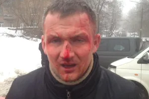 Побиття Левченко: з'явилося провокаційне відео з нардепом