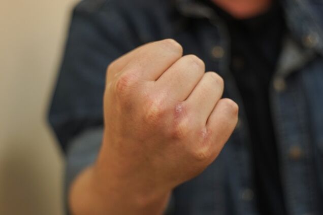 'Война же идет!' Выяснились подробности нападения на критиков 'российской попсы' во Львове